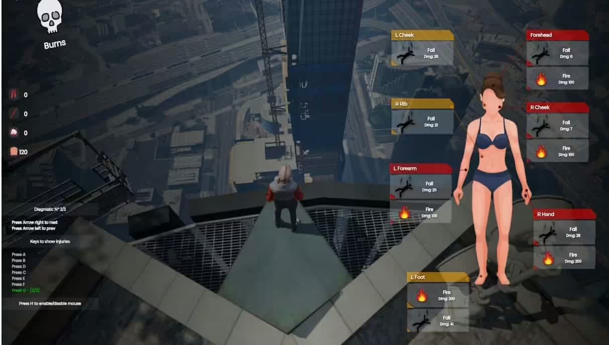Body Damages V2 esx FiveM Script